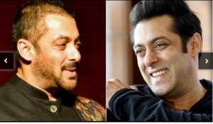 salmaan khan hair transplant