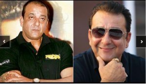 sanjay dutt hair transplant