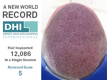 Continuing the Trend of Setting New World Records! - DHI International