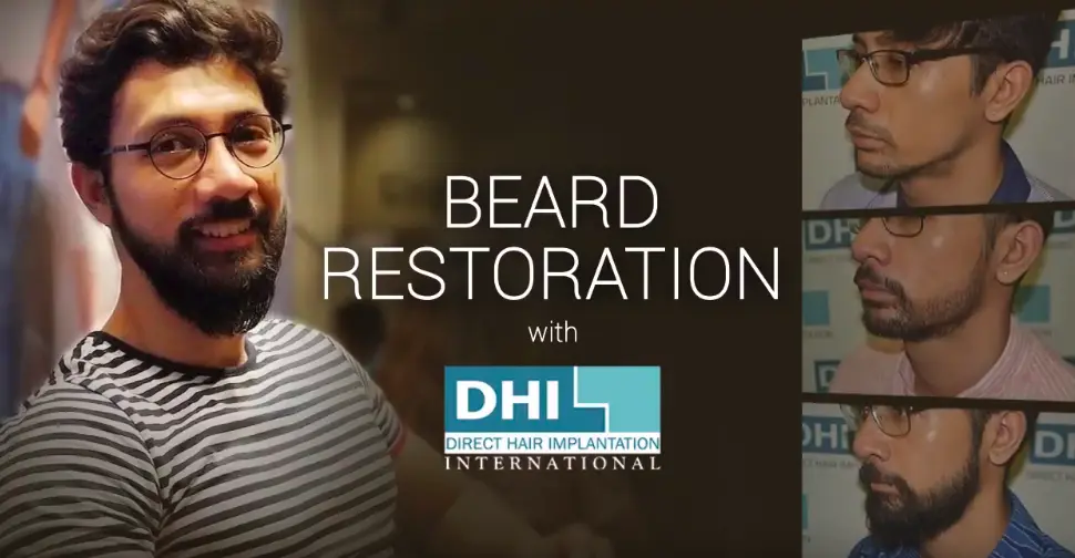 beard restoration results