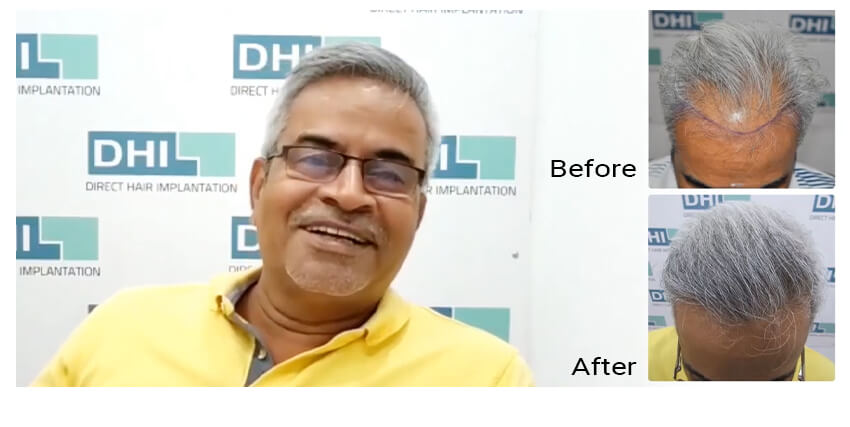 Hair Treatment Before and After Results