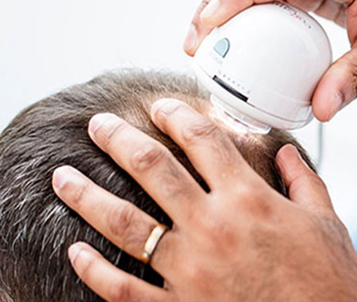 dhi-products-1-1nymrng technique for hair loss diagnose