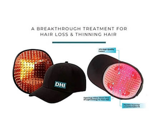 DHI laser cap for hair loss