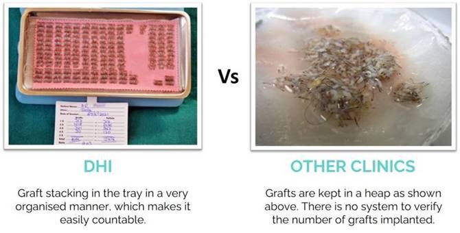 DHI Versus other Technique Graft Tray Protocols