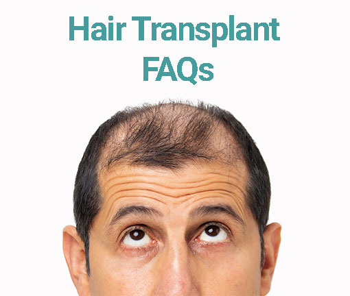 HAIR TRANSPLANT FREQUENT ASKED QUESTIONS - FAQs