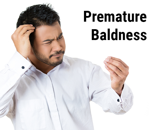 Premature Baldness