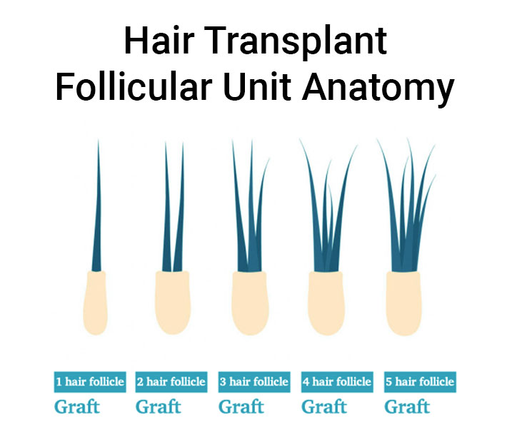 Hair Transplant Follicular Unit Anatomy