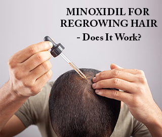 Minoxidil For Hair Growth