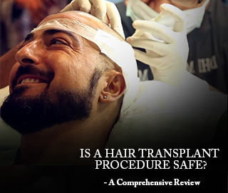 Is a Hair Transplant Procedure Safe