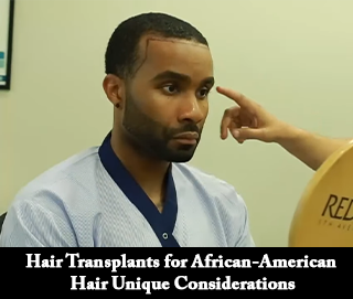afro american hair transplant