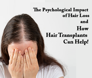 psychological impact of hair loss