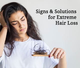 Extreme hair Loss Treatment Options