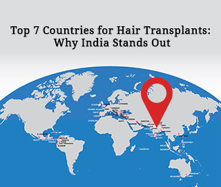 Top 6 countries for hair transpalnt treatments