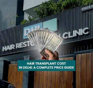 Hair Transplant Cost in Delhi A Complete Price Guide Hair Transplant Cost in Delhi
