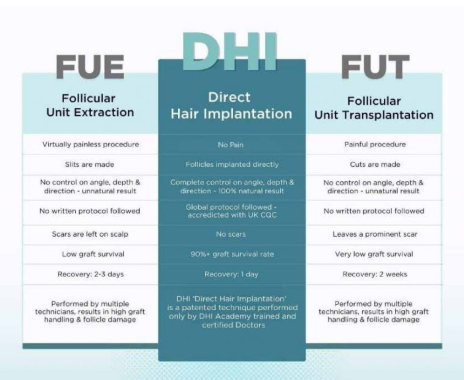 Hair Transplant Techniques