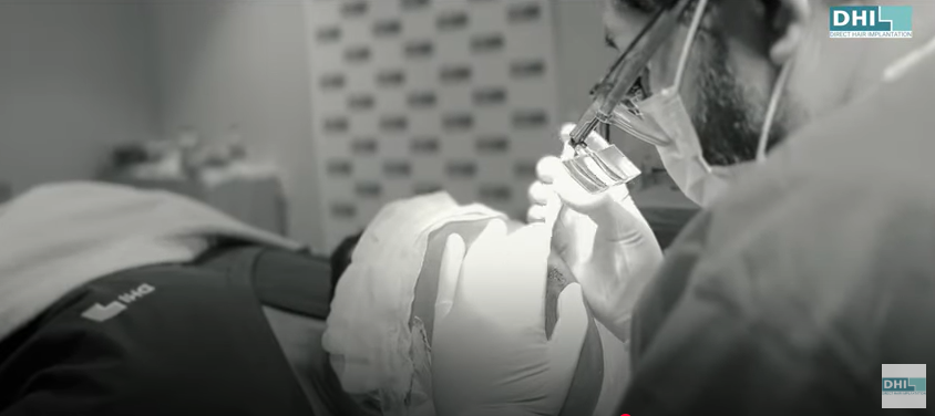 Hair Transplant
