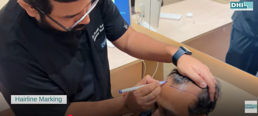Hairline Marking