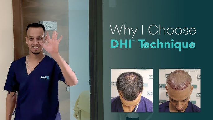 DHITM Technique