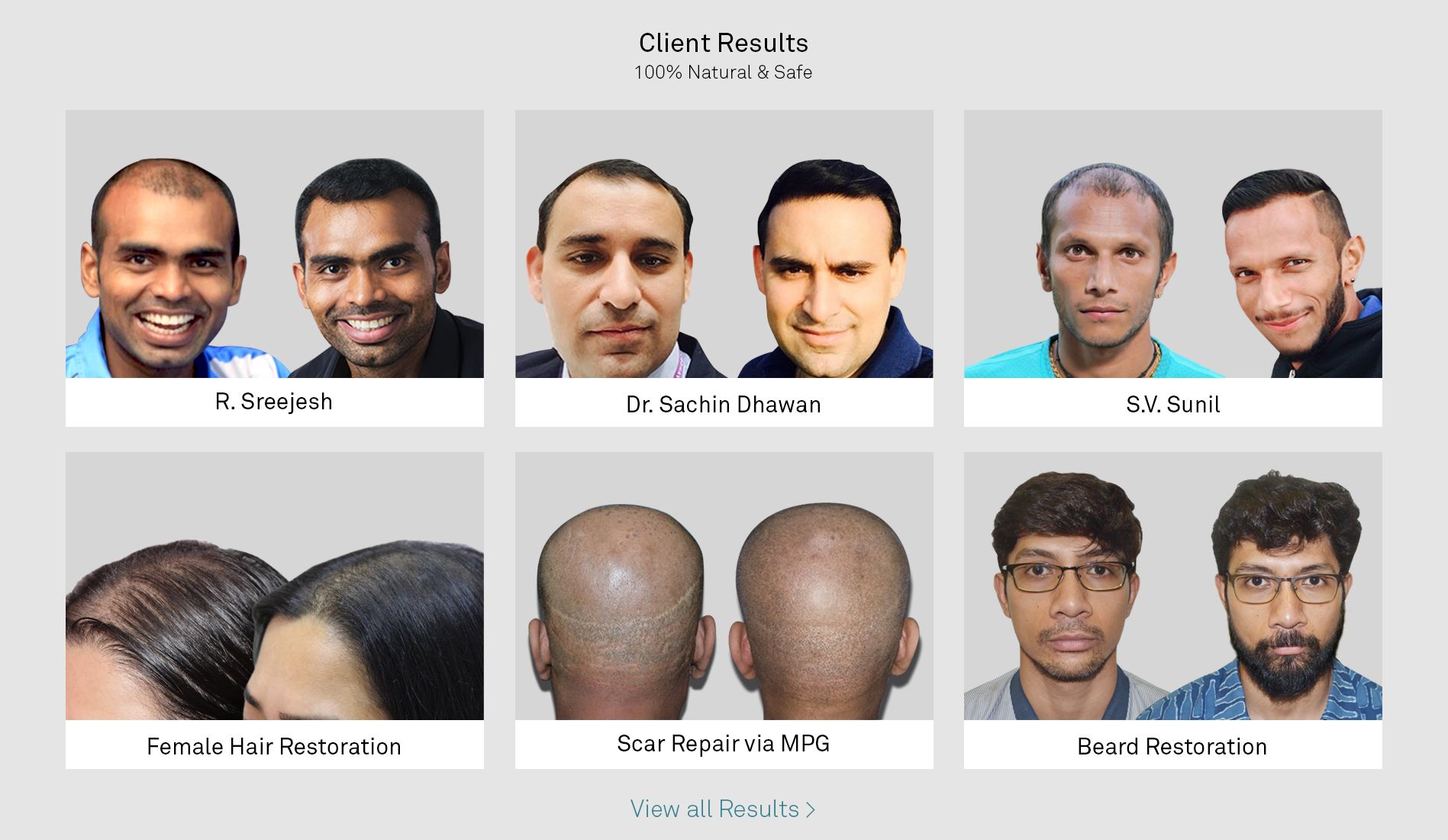 Hair Implant in India Hair Implantation Centre in Delhi