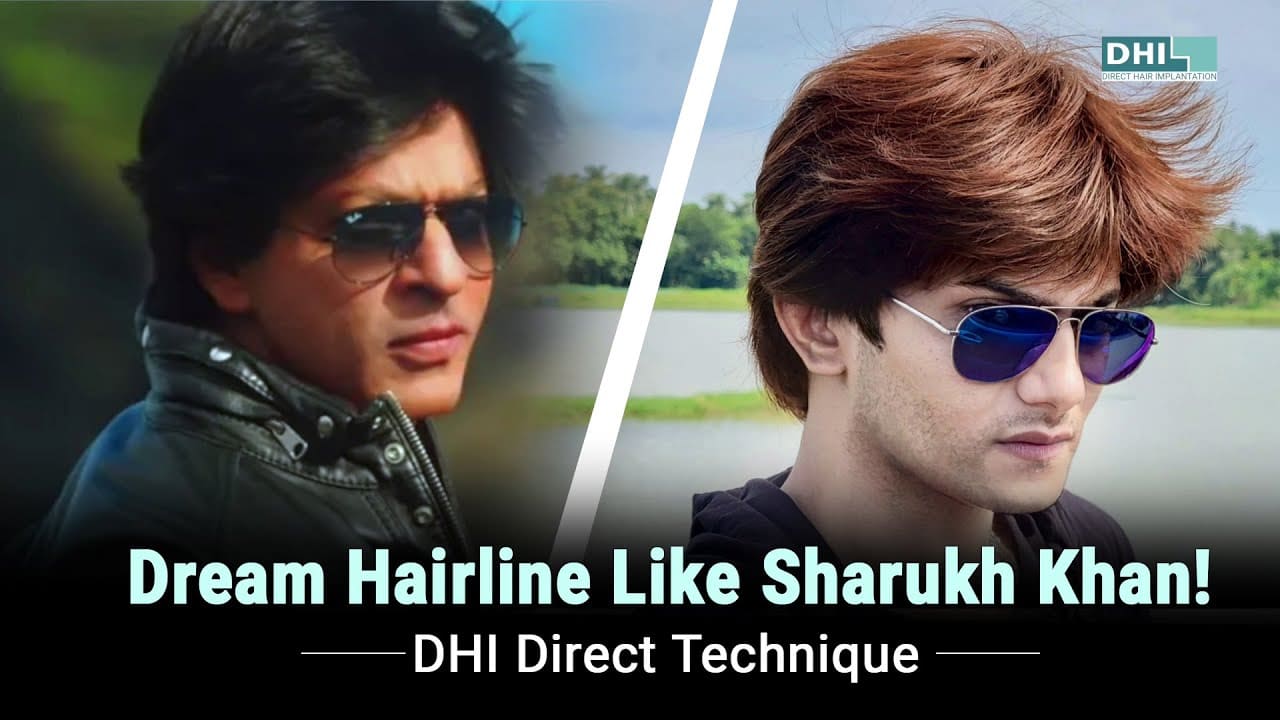 best hair transplant in india