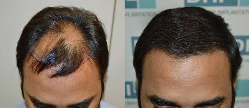 Pankaj Mirchandani before and after