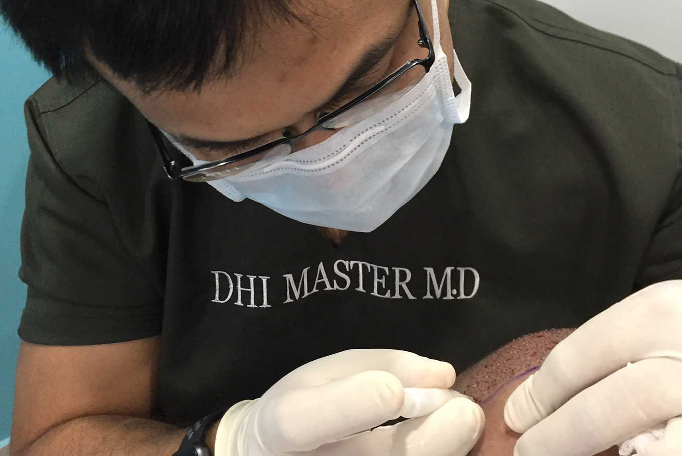 DHI Hair Transplant