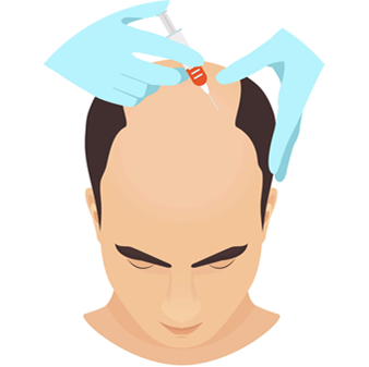 PRP hair treatment