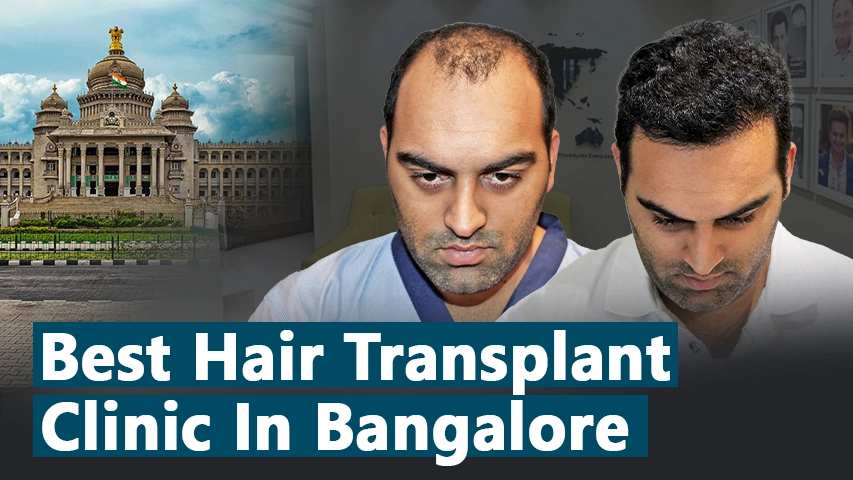 hair transplant video 1