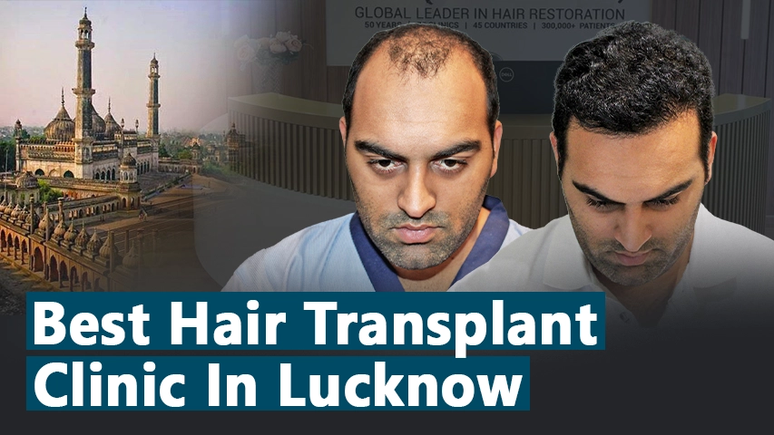 hair transplant video 1