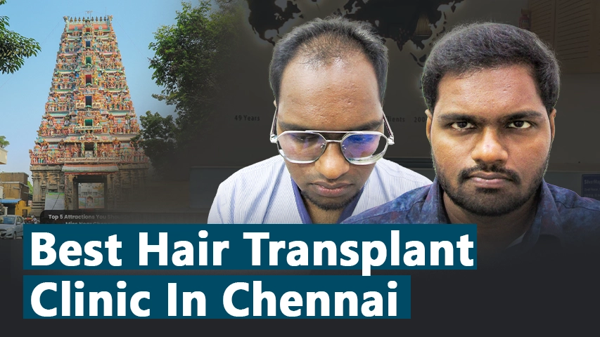 hair transplant video 1