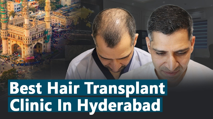 hair transplant video 1