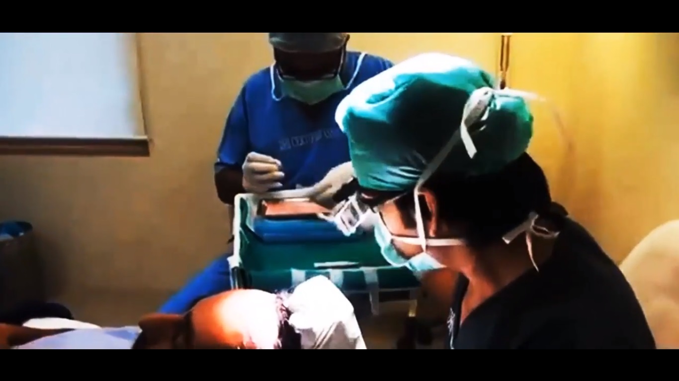 hair transplant video 1