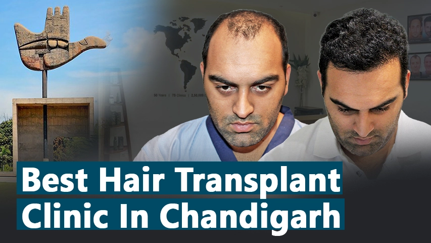 hair transplant video 1