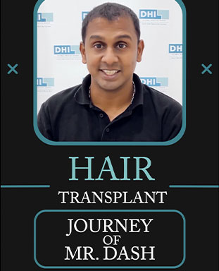 hair transplant video 1