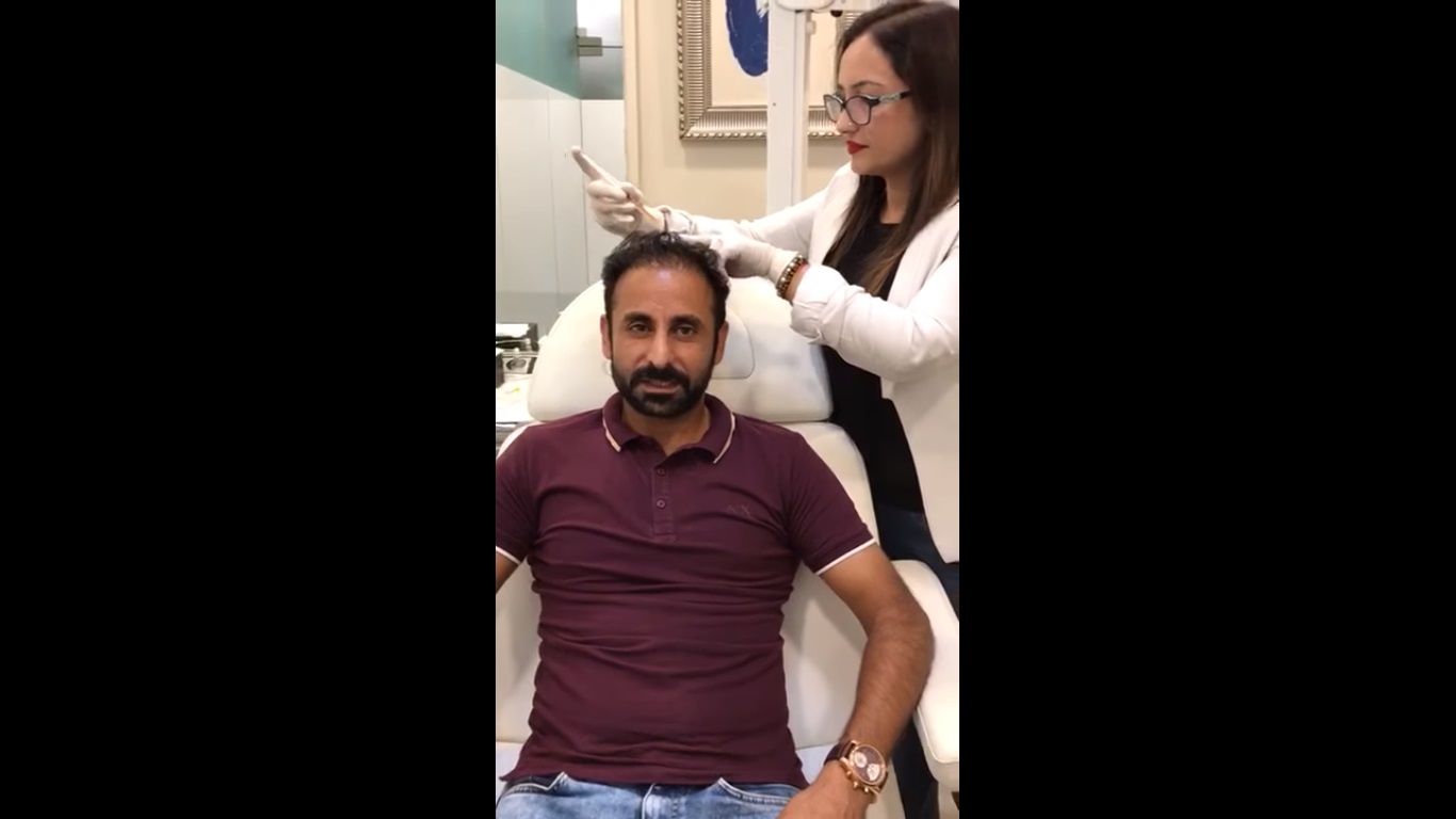 hair transplant video 1