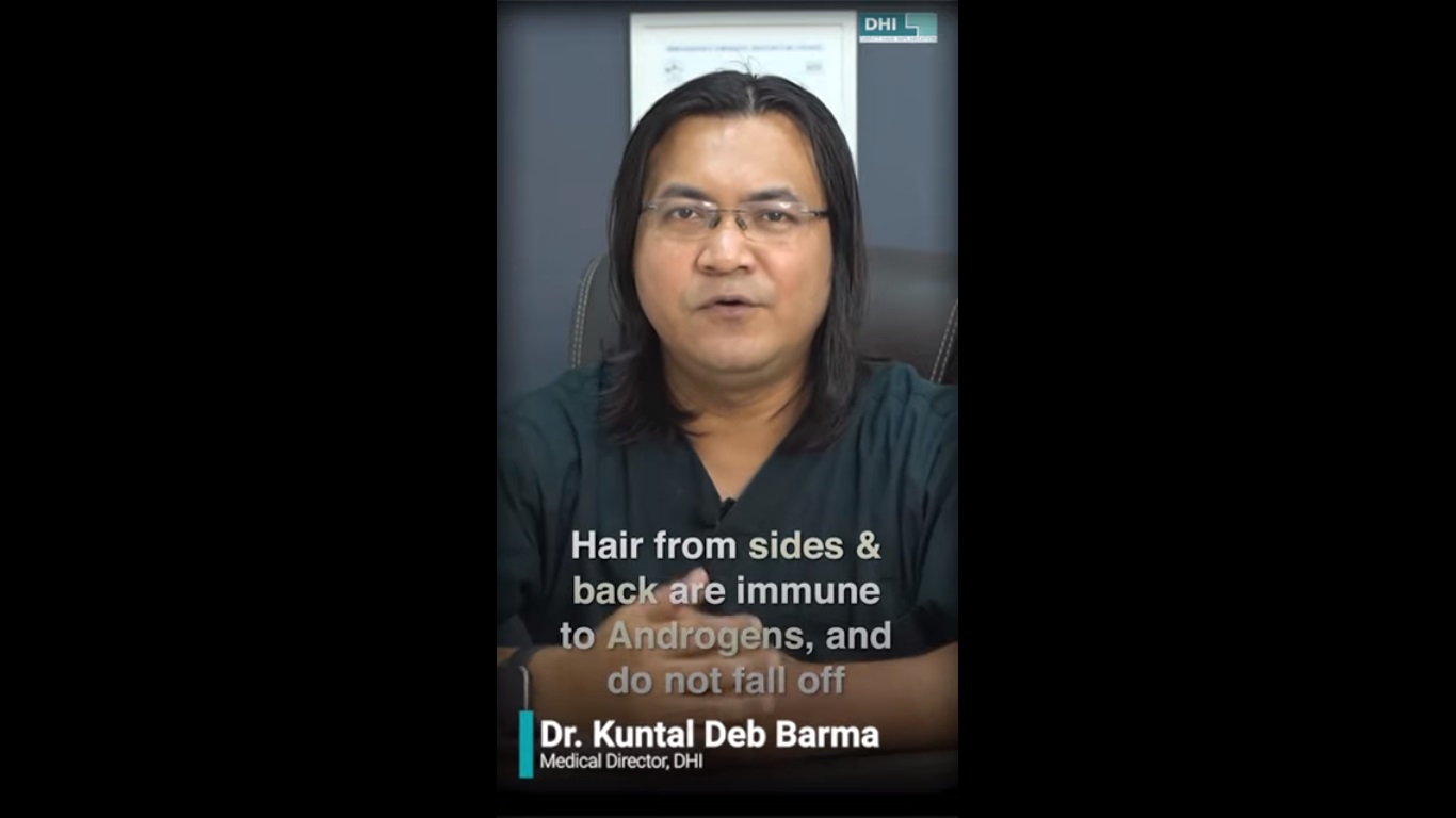 hair transplant video 1